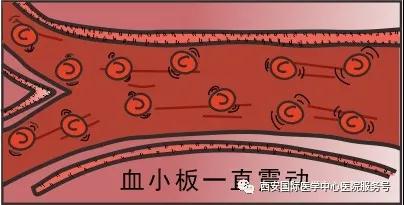 【科普】血小板是正常值的三倍？專家提醒小心血栓和出血！