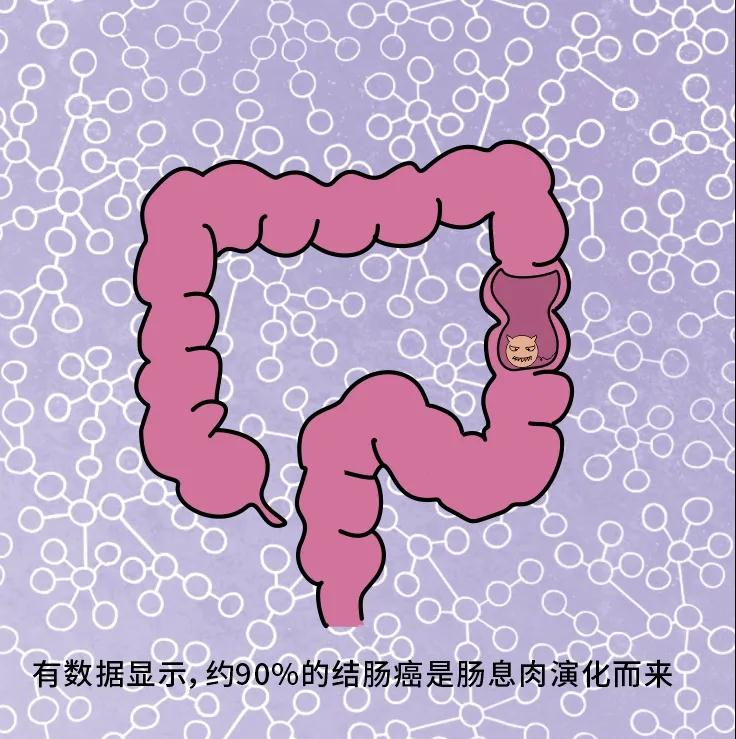 奪走“黑豹”生命的結(jié)腸癌，到底什么來頭？