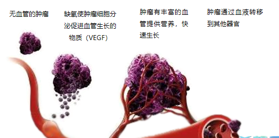 晚期腫瘤為什么會復發(fā)轉移？