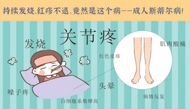 持續(xù)發(fā)燒、紅疹不退……她終于在這里治好了這個(gè)罕見(jiàn)病