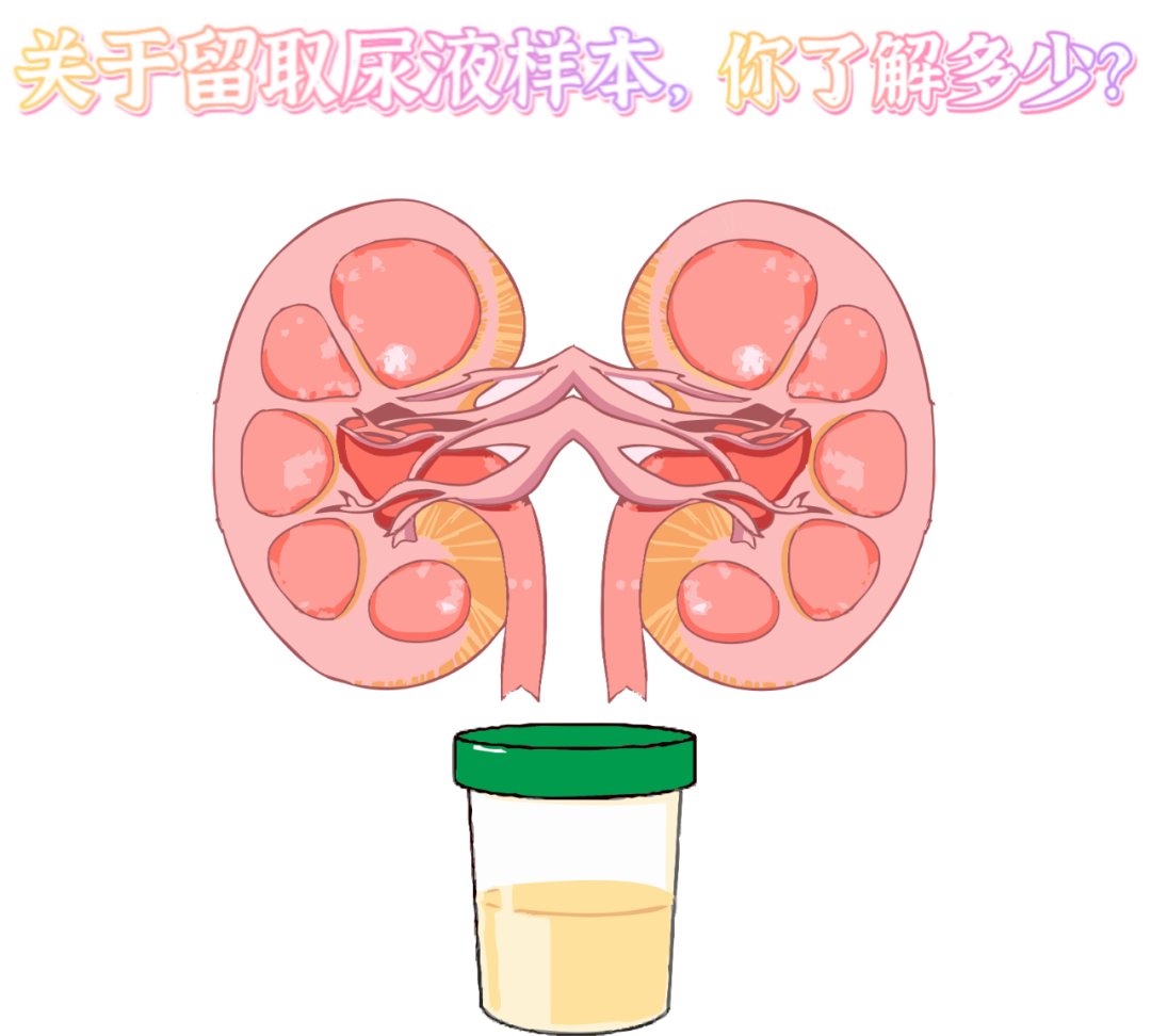 做尿檢，不得不說(shuō)的注意事項(xiàng)！