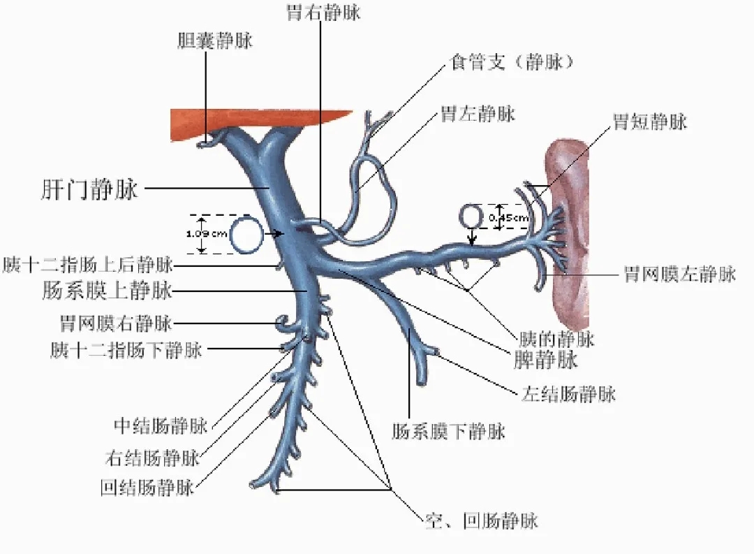 反復(fù)嘔血、黑便怎么辦？TIPS手術(shù)能解決
