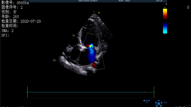 心電圖異常，心臟卻沒事，罪魁禍?zhǔn)资恰?>
				             </a>
                <div   id=