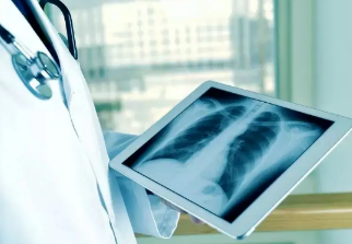 健康呼吸④體檢發(fā)現(xiàn)肺結(jié)節(jié)，我該怎么辦？