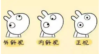 小baby老歪著頭？警惕斜頸! 這樣糾正……