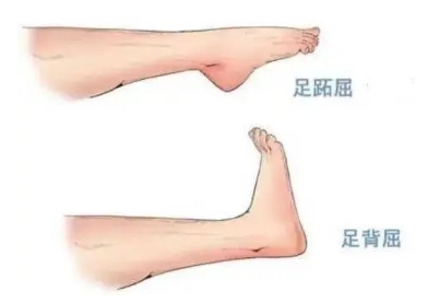 扭胯小連步、動(dòng)感搖花手……“科目三”雖火，運(yùn)動(dòng)損傷也要防！