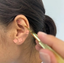 中醫(yī)護眼 點亮“睛”彩世界！又一波福利來襲