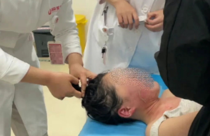 14歲，面、頸、胸燙傷，只因中午那鍋面湯…